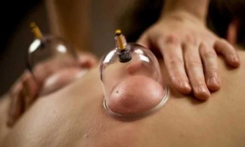 الحجامة علاج من الطب البديل ذو فوائد صحية عديدة